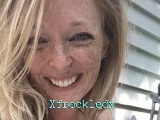 Xfreckledx
